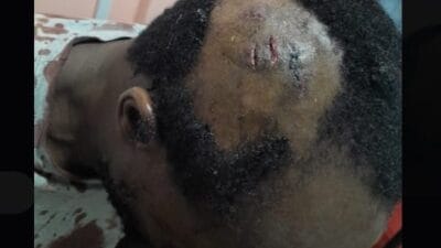 Buruburu Violence