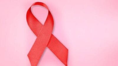 Hiv And Aids