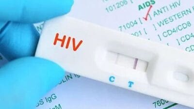 New hiv prevention drug yeztugo lenacapavir