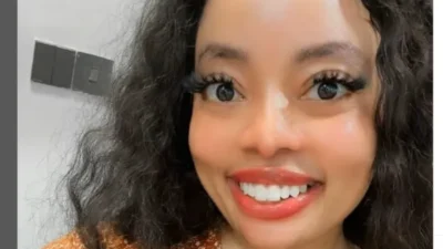 Gloria ntazola cosmetic surgery