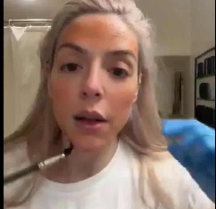 Sarah talley blood face smear skincare photo