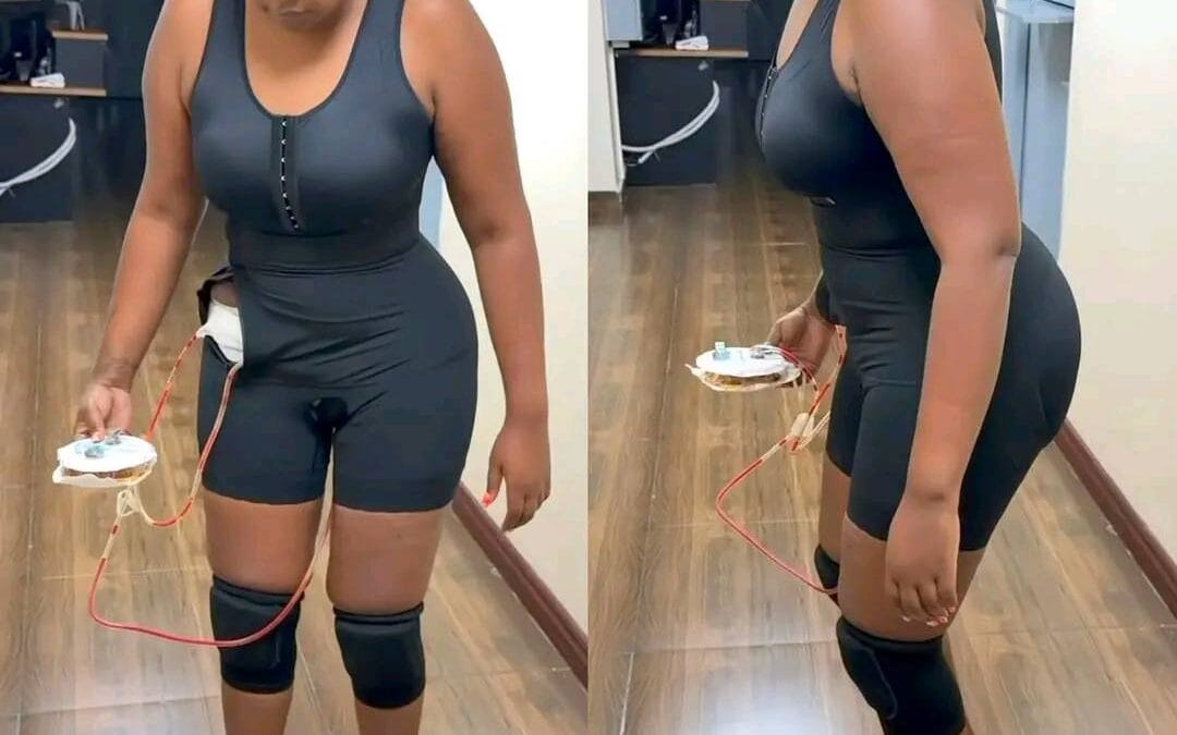 Lydia wanjiru bbl surgery bursts