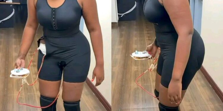 Lydia wanjiru bbl surgery bursts