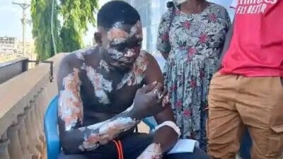 Driver burnt by wife photo
