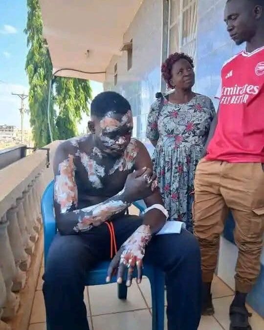 Driver burnt by wife photo