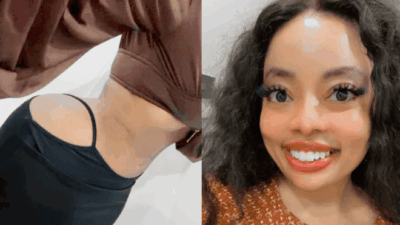Gloria ntazola surgery photo
