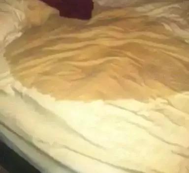 Beddings soaked with Urine Beddings soaked with Urine