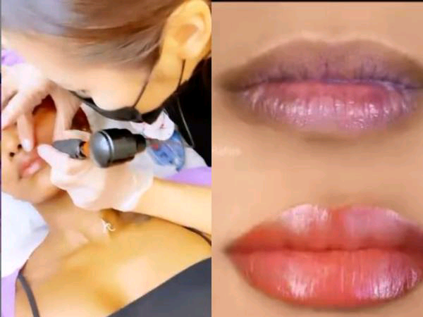 Socialite Huddah Monroe lips surgery photos