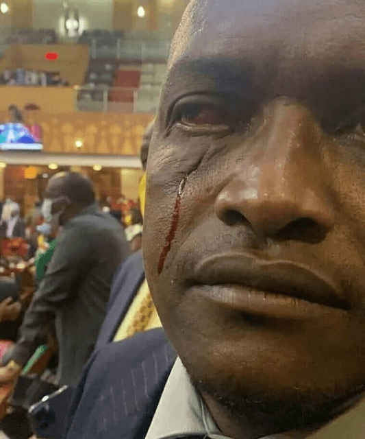Sigowet Soin MP Benard Koros beaten at the parliament over political parties bill vote