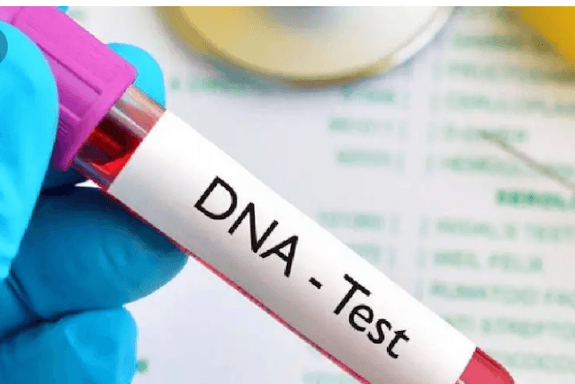 DNA tests results kit DNA tests results kit