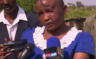 The woman who was chopped off her hands in machakos by her husband. Mwende is the woman who was chopped off body parts in Machakos by her husband.