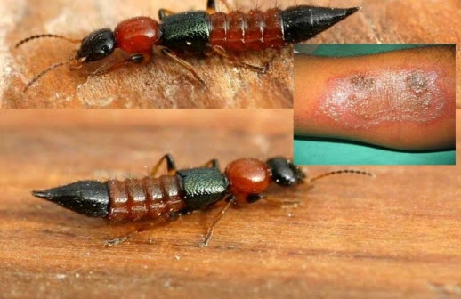 [VIDEO] Nairobi Fly  -Millions of Narrow Bee Flies ‘ Nairobi Flies’  invade Kabarnet, Baringo county