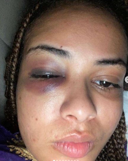Popular artist Madtraxx severely beat his wife Salma Hussein Adbiraboh, leading to her hospitalisation. Popular artist Madtraxx severely beat his wife Salma Hussein Adbiraboh, leading to her hospitalisation.