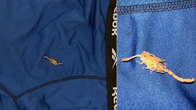 a scorpion allegedly stung him on the testicles