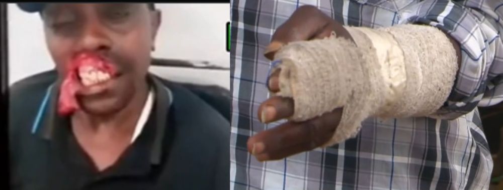 Ruiru man biting lips